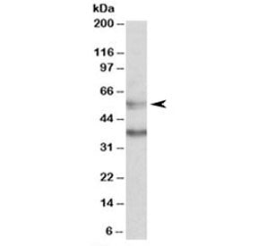 CBARA1 Antibody / MICU1