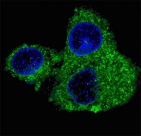 Fatty Acid Synthase Antibody