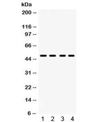 Western blot testing of human 1) HeLa, 2) COLO320, 3) SW620, 4) HepG2 lysate with PAR2 antibody. Exp