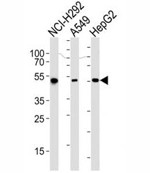 ALDH2 Antibody