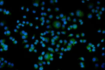 BAG5 Antibody