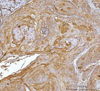 CRABP2 Antibody / Cellular retinoic acid-binding protein 2