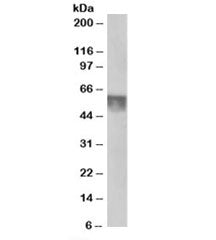 Western blot testing of human testis lysate with KPNA4 at 0.5ug/ml. Predicted molecular weight: ~58k