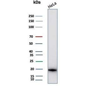Alpha B Crystallin Antibody / CRYAB