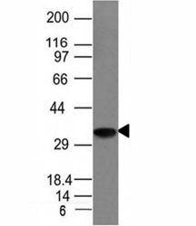 Western blot analysis of Raji cell lysate using CLIP antibody (CLIP/1133). Expected molecular weight
