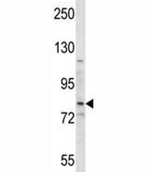 SMO Antibody