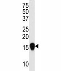 SUMO4 Antibody (V55 Mutant)