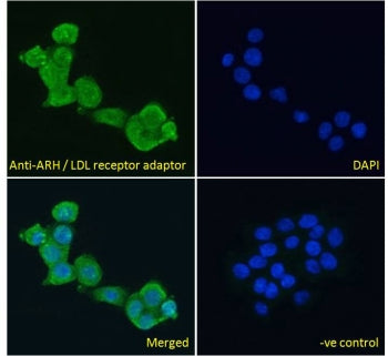 IF/ICC testing of fixed and permeabilized human A431 cells with ARH antibody (green) at 10ug/ml and 