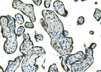 IHC staining of FFPE human placental tissue with BRAF antibody. HIER: boil tissue sections in pH8 ED