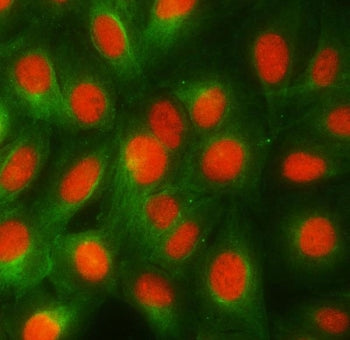 Immunofluorescent staining of FFPE human HeLa cells with RBMY1A1 antibody (red) and Beta Tubulin mAb