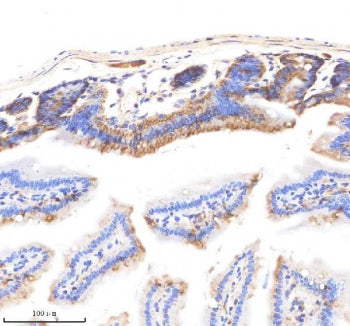EpCAM Antibody