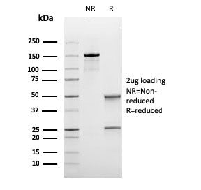 SDS-PAGE analysis of purified, BSA-free recombinant Bcl6 antibody (clone rBCL6/1475) as confirmation