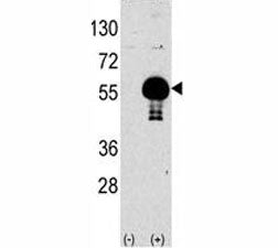 AKT2 Antibody