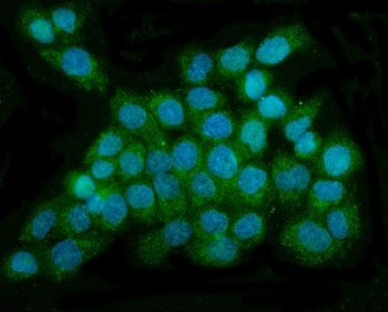 DNAJC6 Antibody