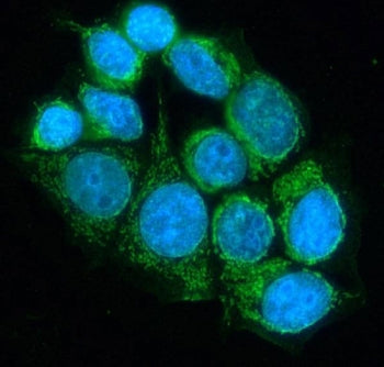 Immunofluorescent staining of FFPE human MCF7 cells with DLD antibody (green) and DAPI nuclear stain