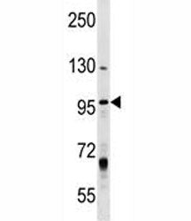 MCM8 antibody western blot analysis in T47D lysate. Expected/observed molecular weight ~94/89 kDa (i