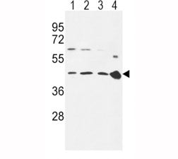 CCR7 Antibody