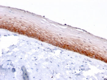 IHC staining of FFPE human cervix with CD44v4/5 antibody (clone 3D2). HIER: boil tissue sections in 
