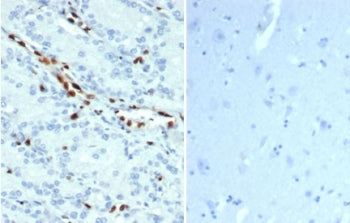 IHC staining of FFPE human prostate tissue (left) and negative control human brain tissue (right) wi