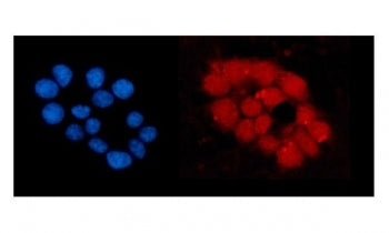 ORC5L Antibody