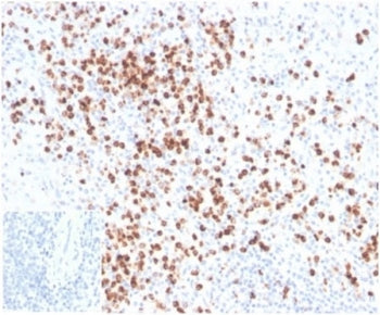 IHC staining of FFPE human spleen tissue with LYZ antibody (clone LYZ/3942). Negative control inset: