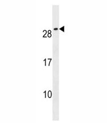 CFC1B Antibody