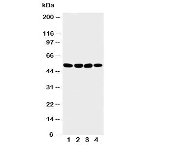Western blot testing with Matrilin 3 antibody; Lane 1: 293T; 2: COLO320; 3: HeLa; 4: A549 lysate
