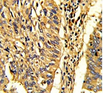 HSP60 Antibody