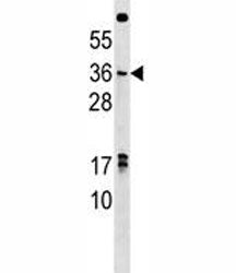 NKX3.1 Antibody