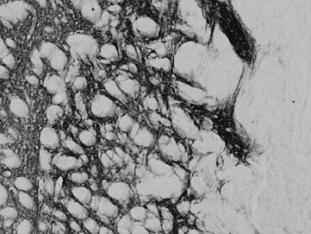 PENK Antibody
