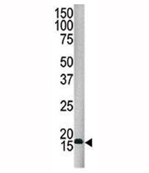 SUMO4 Antibody