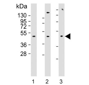 ADRA2B Antibody / Alpha-2B Adrenergic Receptor
