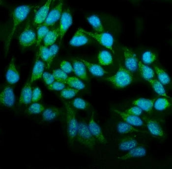 Immunofluorescent staining of FFPE human HeLa cells with DAI antibody (green) and DAPI nuclear stain