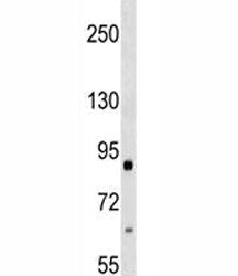 Integrin beta 2 Antibody