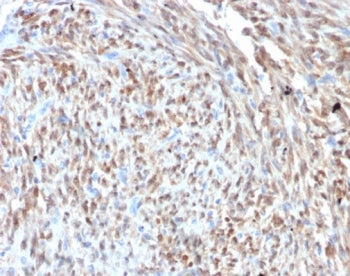 CDK4 Antibody