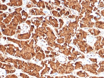 Growth Hormone Antibody / GH1