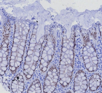 SATB2 Antibody