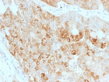 IHC staining of FFPE human kidney with ROR2 antibody. HIER: boil tissue sections in pH 9 10mM Tris w