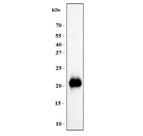 Growth Hormone Antibody / GH1