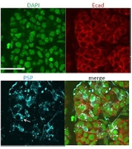 Psp Antibody