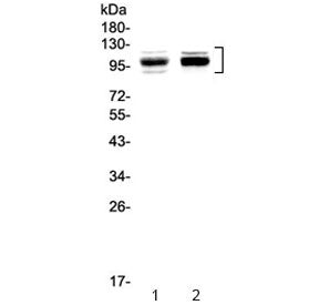 Western blot testing of 1) rat thymus and 2) mouse thymus with SATB1 antibody at 0.5ug/ml. Predicted