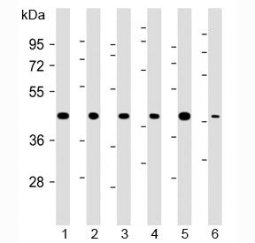Western blot testing of 1) human 293, 2) (h) HeLa, 3) (h) MDA-MB-231, 4) rat H-4-II-E, 5) (h) HCT-11