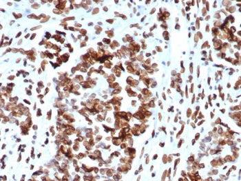 MDM2 Antibody