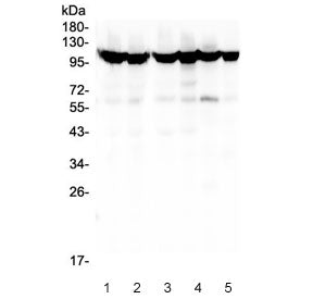 Western blot testing of human 1) HEK293, 2) HEK293 (different lot), 3) HeLa, 4) COLO-320, 5) T-47D a