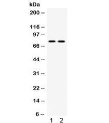 Western blot testing of 1) mouse testis and 2) human 22RV1 lysate with MDM4 antibody. Predicted mole
