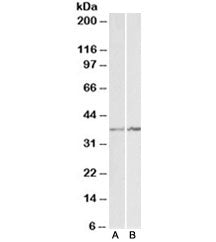 Annexin A1 Antibody