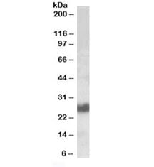Western blot testing of human tonsil lysate with CD90 antibody at 0.1ug/ml. Predicted molecular weig