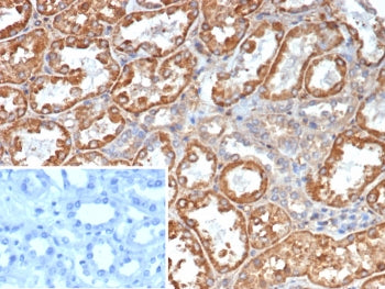 Transferrin Antibody