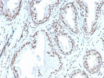 IHC staining of FFPE human prostate with recombinant ATRX antibody (clone rATRX/3446). HIER: boil ti