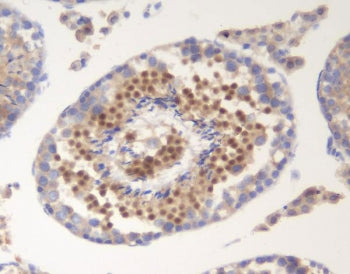 IHC staining of FFPE mouse testis with SOX6 antibody. HIER: boil tissue sections in pH8 EDTA for 20 